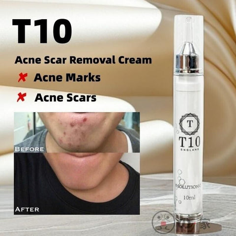 【英國製】T10 暗瘡膏 神奇暗瘡去疤膏  袪印膏 10ml miracle acne scar removal cream